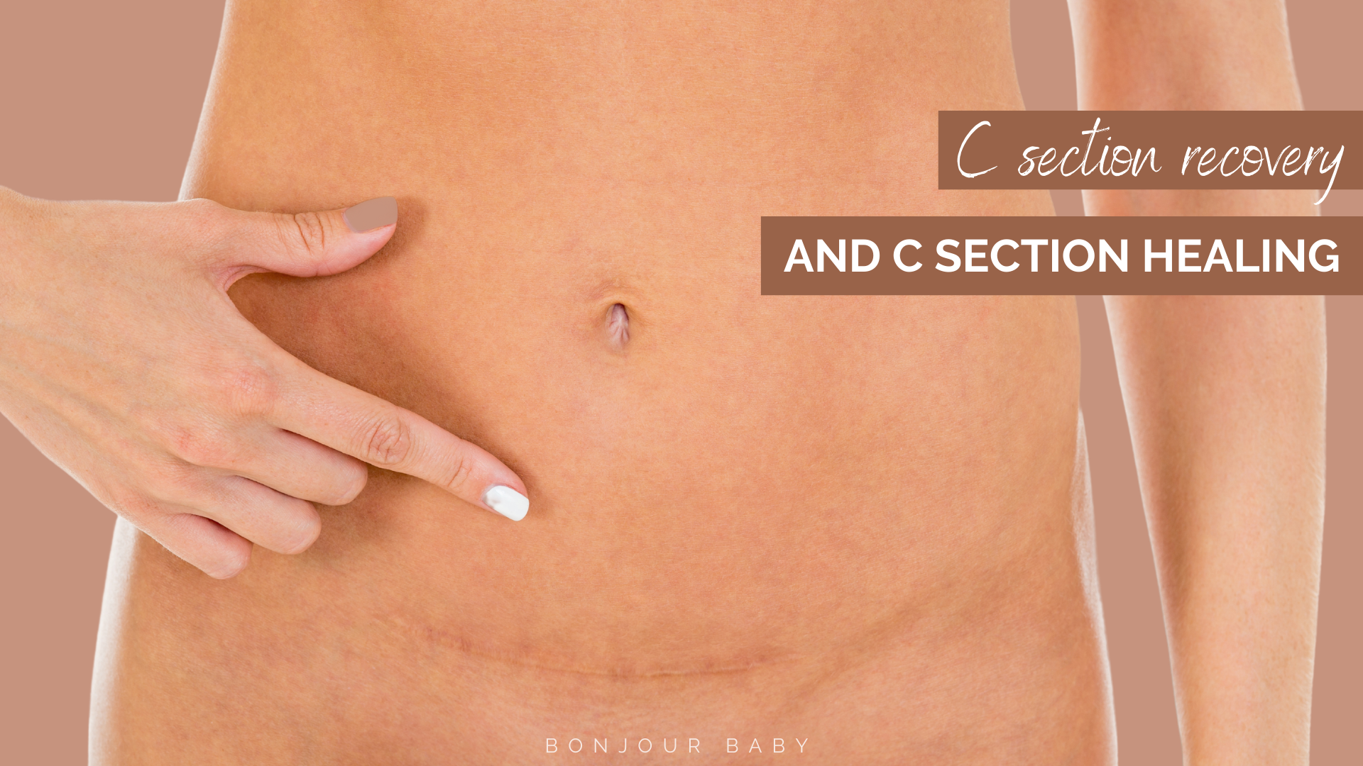 3 things about c section recovery and c section scar healing that you must  know